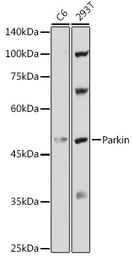 Anti-Parkin antibody used in Western Blot (WB). GTX65812