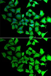 Anti-Transaldolase antibody used in Immunocytochemistry/ Immunofluorescence (ICC/IF). GTX65820