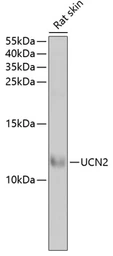 Anti-Urocotin 2 antibody used in Western Blot (WB). GTX65915