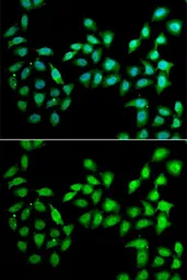 Anti-Urocotin 2 antibody used in Immunocytochemistry/ Immunofluorescence (ICC/IF). GTX65915