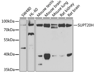 Anti-FAM48A antibody used in Western Blot (WB). GTX65918