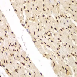 Anti-FAM48A antibody used in IHC (Paraffin sections) (IHC-P). GTX65918