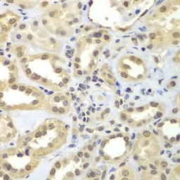 Anti-FAM48A antibody used in IHC (Paraffin sections) (IHC-P). GTX65918