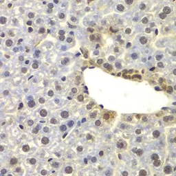 Anti-FAM48A antibody used in IHC (Paraffin sections) (IHC-P). GTX65918