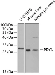 Anti-ProDynorphin antibody used in Western Blot (WB). GTX65945