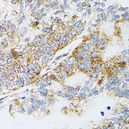 Anti-ProDynorphin antibody used in IHC (Paraffin sections) (IHC-P). GTX65945