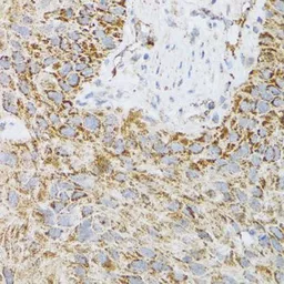 Anti-ProDynorphin antibody used in IHC (Paraffin sections) (IHC-P). GTX65945