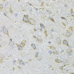 Anti-ProDynorphin antibody used in IHC (Paraffin sections) (IHC-P). GTX65945