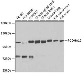 Anti-PCDHA12 antibody used in Western Blot (WB). GTX65979