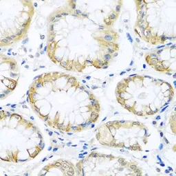 Anti-PCDHA12 antibody used in IHC (Paraffin sections) (IHC-P). GTX65979