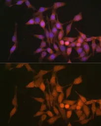 Anti-PSMB6 antibody used in Immunocytochemistry/ Immunofluorescence (ICC/IF). GTX66015