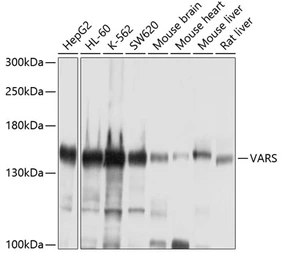 Anti-Valyl tRNA synthetase antibody used in Western Blot (WB). GTX66016