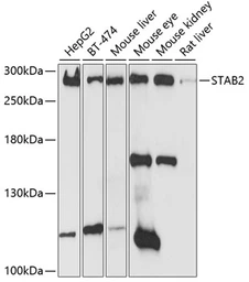 Anti-STAB2 antibody used in Western Blot (WB). GTX66047