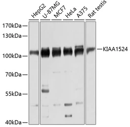 Anti-CIP2A antibody used in Western Blot (WB). GTX66094