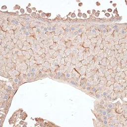 Anti-CIP2A antibody used in IHC (Paraffin sections) (IHC-P). GTX66094