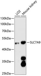 Anti-SLC7A9 antibody used in Western Blot (WB). GTX66127