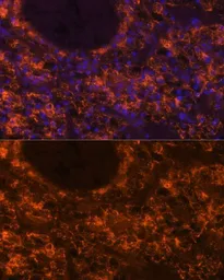 Anti-SLC7A9 antibody used in IHC (Paraffin sections) (IHC-P). GTX66127