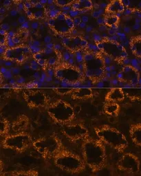 Anti-SLC7A9 antibody used in IHC (Paraffin sections) (IHC-P). GTX66127