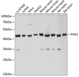 Anti-PGK2 antibody used in Western Blot (WB). GTX66145