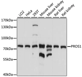 Anti-Protein S antibody used in Western Blot (WB). GTX66404