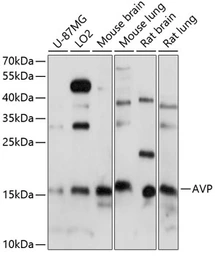 Anti-Vasopressin antibody used in Western Blot (WB). GTX66409