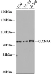 Anti-CLCNKA antibody used in Western Blot (WB). GTX66428