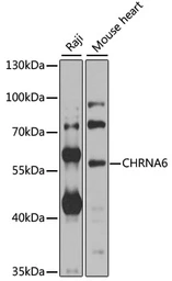 Anti-AChR alpha 6 antibody used in Western Blot (WB). GTX66522