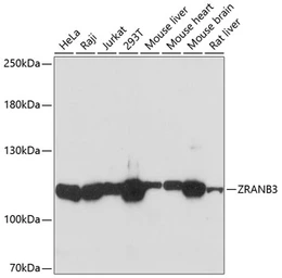 Anti-ZRANB3 antibody used in Western Blot (WB). GTX66576