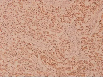 Anti-MEK2 antibody used in IHC (Paraffin sections) (IHC-P). GTX66622