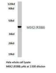 Anti-MEK2 antibody used in Western Blot (WB). GTX66622