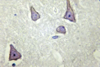 Anti-Kir6.2 antibody used in IHC (Paraffin sections) (IHC-P). GTX66690