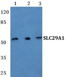 Anti-SLC29A1 antibody used in Western Blot (WB). GTX66737