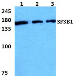 Anti-SF3B1 antibody used in Western Blot (WB). GTX66743