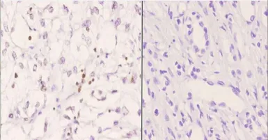 Anti-TFE3 antibody used in IHC (Paraffin sections) (IHC-P). GTX66746