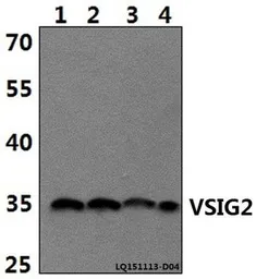 Anti-VSIG2 antibody used in Western Blot (WB). GTX66808