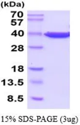 Human GAPDH protein (active). GTX67008-pro