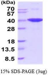 Mouse GAPDH protein, His tag (active). GTX67009-pro