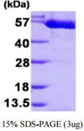 Human PKM protein, His tag (active). GTX67124-pro