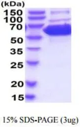 Mouse PKM protein, His tag (active). GTX67125-pro