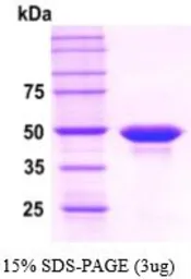 Human PPM1A protein, His tag (active). GTX67135-pro