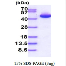 Human PGK1 protein, His tag. GTX67633-pro