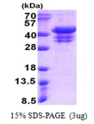 Human UFD1L protein, His tag. GTX67927-pro