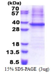 Human NIPSNAP protein, His tag. GTX67976-pro