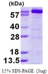 Human GMP synthase protein, His tag. GTX68009-pro