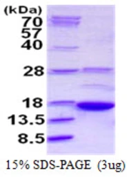 Human AKAP7 protein, His tag. GTX68065-pro