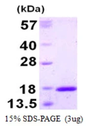 Human TXNL4A protein, His tag. GTX68199-pro