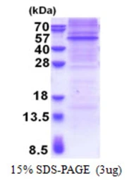 Mouse Rapsyn protein, His tag. GTX68280-pro