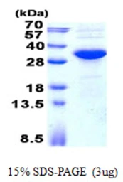 Human KCTD15 protein, His tag. GTX68724-pro