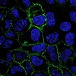 Anti-Carbonic Anhydrase IX antibody [GT12] used in Immunocytochemistry/ Immunofluorescence (ICC/IF). GTX70020