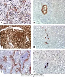 Anti-Carbonic Anhydrase IX antibody [GT12] used in IHC (Paraffin sections) (IHC-P). GTX70020